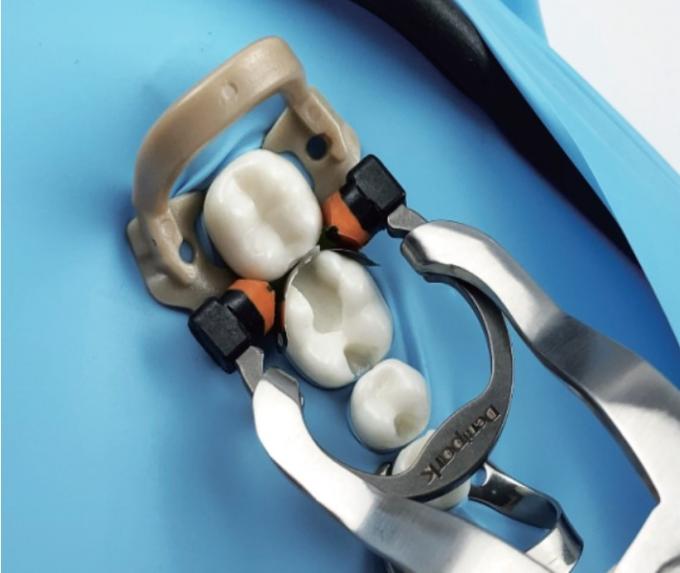 Tofflemire Matrix Band Holder Dental A3 Bands Clamp Ring Resin 3
