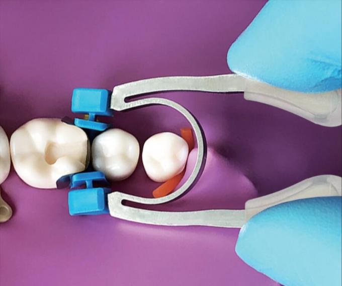 Universal Band Dental Sectional Matrix Holder In Dentistry G2 Autoclavable M2 Handheld Clamping Ring R4 1