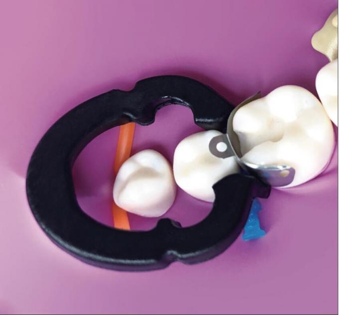 Dental Metal Matrix Band Dentist M4 1.0 2