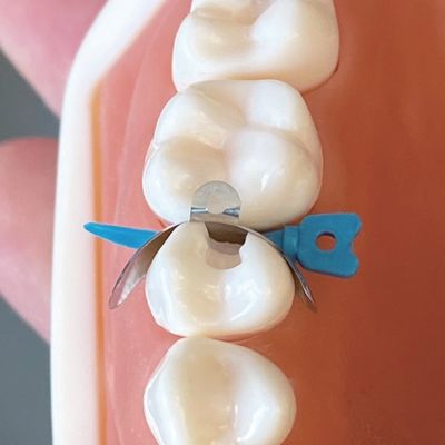 Dental Sectional Matrix System Clamp Ring R1